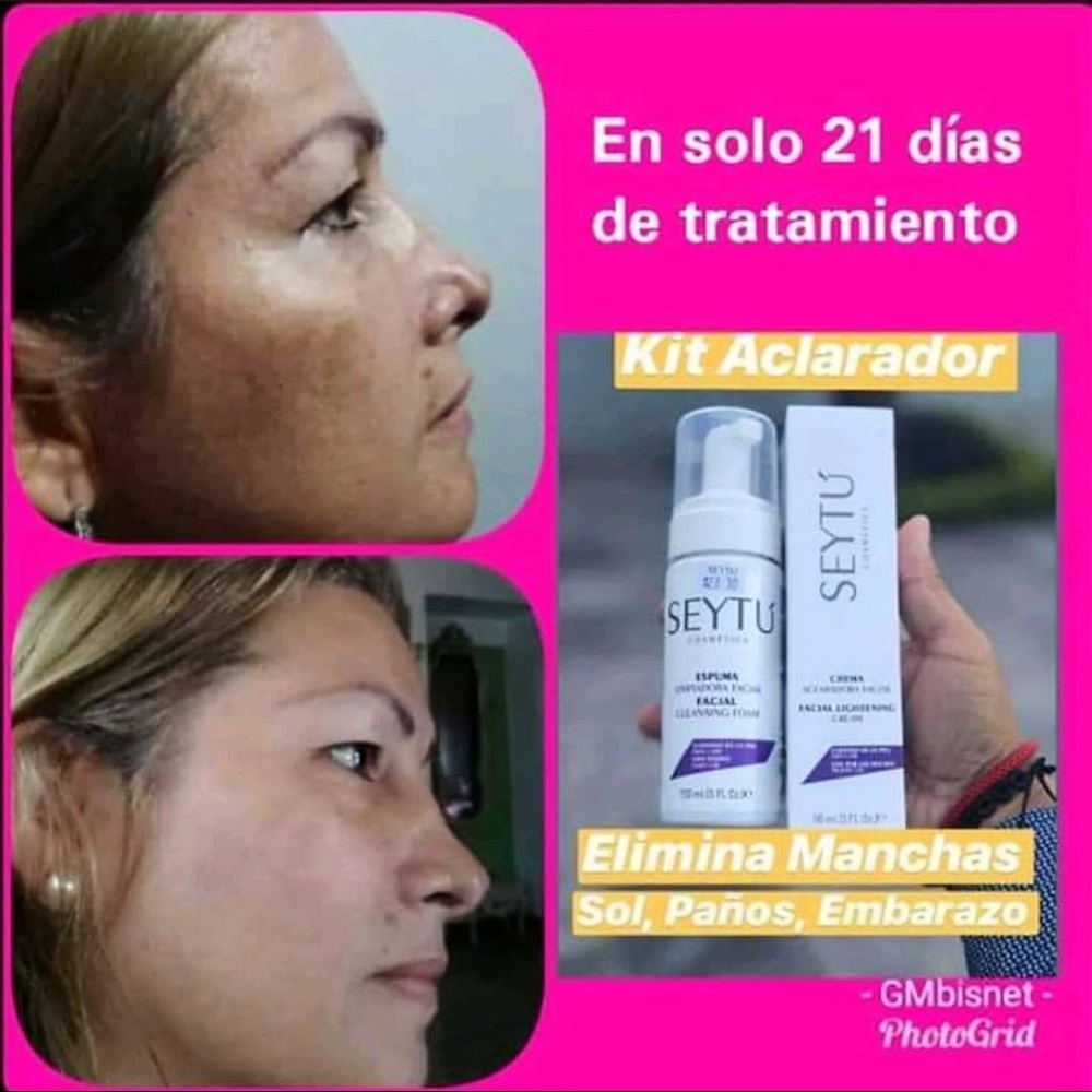 Testimonio kit quita manchas del sol, paño etc